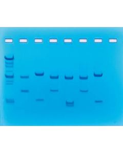 DNA Fingerprinting - Using Restriction Enzymes [1829]