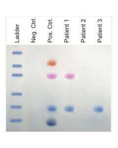 Edvotek AIDS Kit III: Simulation of HIV Detection by Protein [80181]